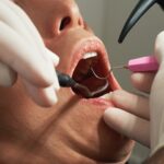 osoba z otwartą buzią podczas badania u dentysty