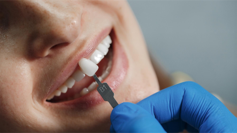 zakładanie implantu zębowego