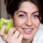 kobieta w aparacie ortodontycznym trzyma nadgryzione jabłko