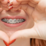 osoba z aparatem ortodontycznym