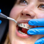 aparat ortodontyczny