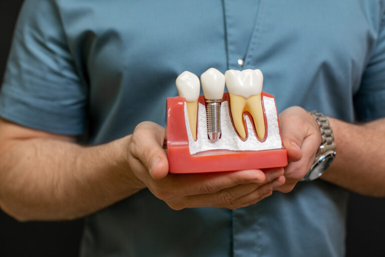 implant zębowy