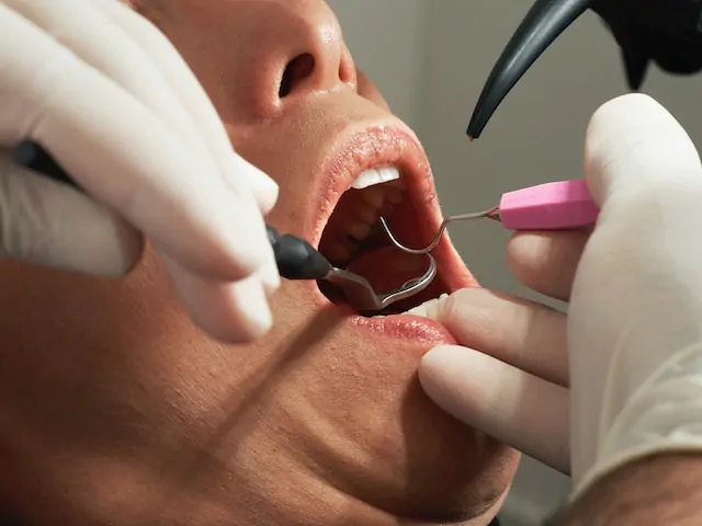 osoba z otwartą buzią podczas badania u dentysty