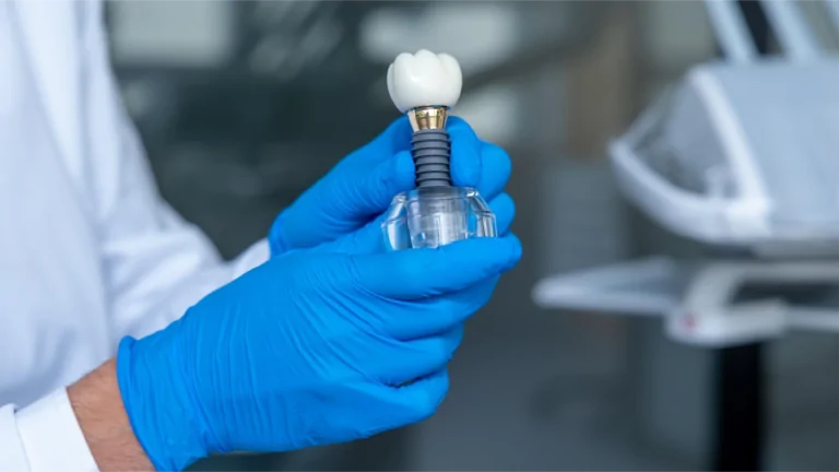 implant zęba